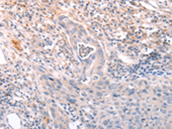 Rabbit Polyclonal Antibody to A4GNT