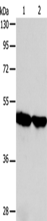 Rabbit Polyclonal Antibody to AADAC