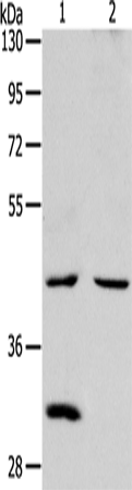 Rabbit Polyclonal Antibody to NCEH1