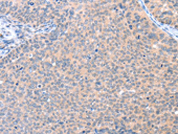 Rabbit Polyclonal Antibody to AADACL2
