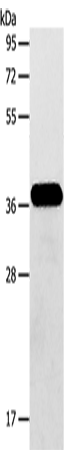 Rabbit Polyclonal Antibody to AASDHPPT