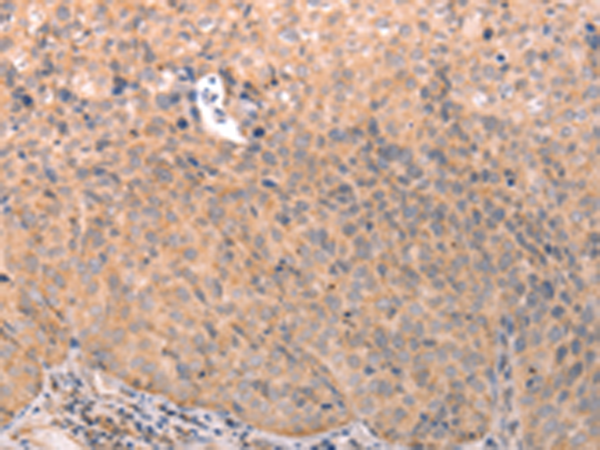 Rabbit Polyclonal Antibody to ABCF2