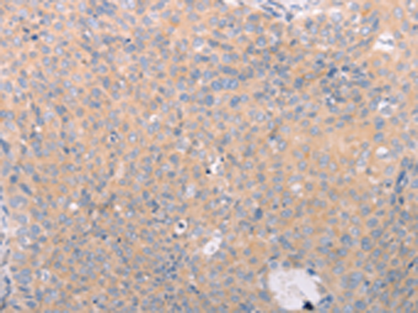 Rabbit Polyclonal Antibody to ABCF3