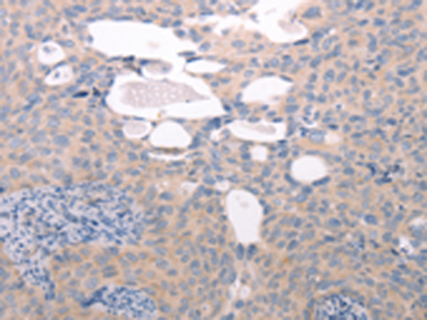 Rabbit Polyclonal Antibody to ABCF1