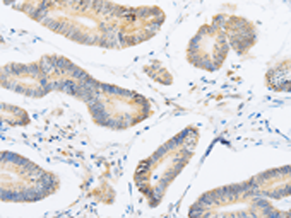 Rabbit Polyclonal Antibody to ABHD1