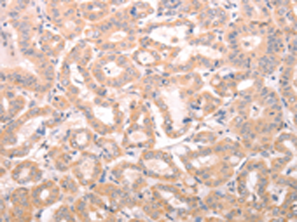 Rabbit Polyclonal Antibody to ABHD12