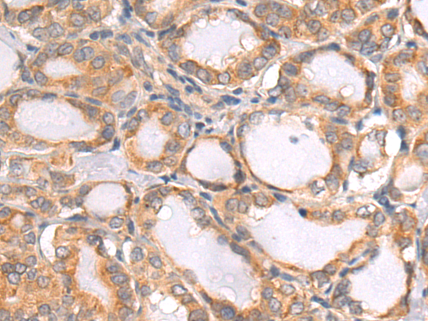 Rabbit Polyclonal Antibody to ABHD5