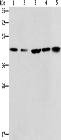 Rabbit Polyclonal Antibody to ACAA2