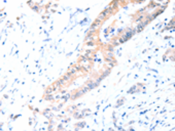 Rabbit Polyclonal Antibody to ACAD10