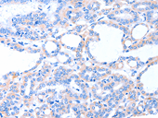 Rabbit Polyclonal Antibody to ACAD8
