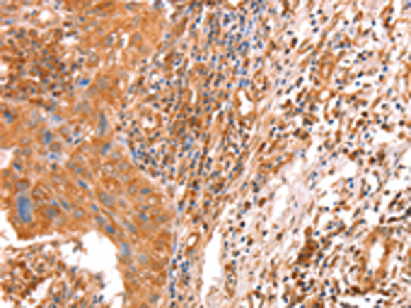 Rabbit Polyclonal Antibody to ACAD9