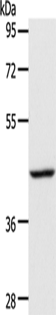 Rabbit Polyclonal Antibody to ACADS