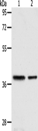 Rabbit Polyclonal Antibody to CNN3