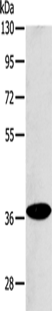 Rabbit Polyclonal Antibody to ACMSD