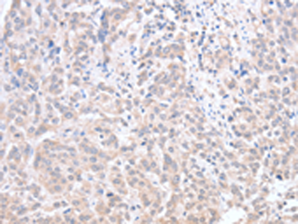 Rabbit Polyclonal Antibody to ACOT1
