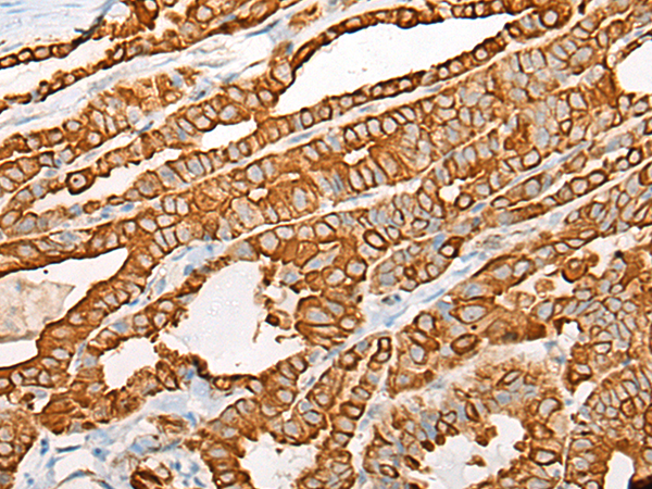 Rabbit Polyclonal Antibody to ACOT7