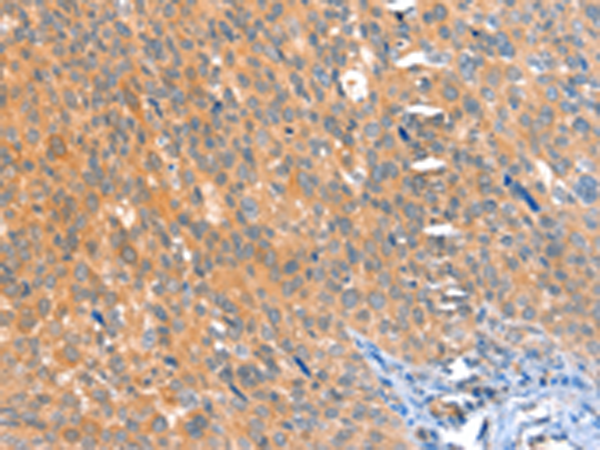 Rabbit Polyclonal Antibody to ACOX3
