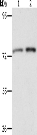 Rabbit Polyclonal Antibody to ACOX2
