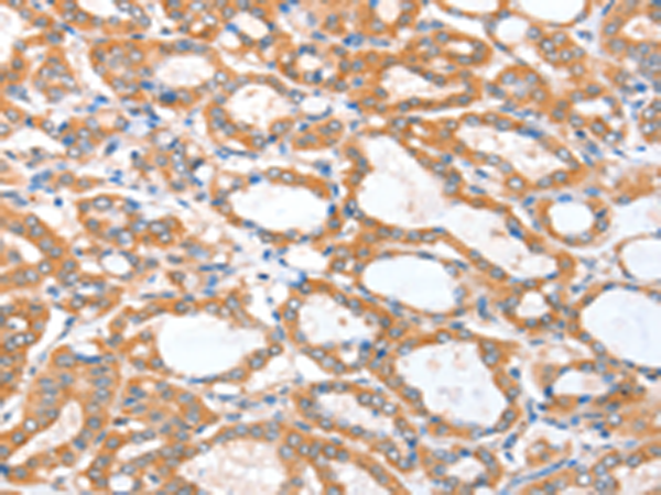 Rabbit Polyclonal Antibody to ACSBG1