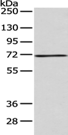 Rabbit Polyclonal Antibody to ACSM5