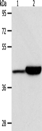Rabbit Polyclonal Antibody to CAPG