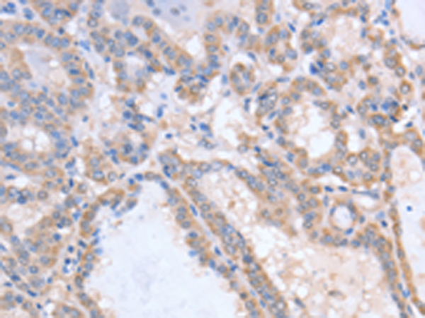 Rabbit Polyclonal Antibody to ACVR1C