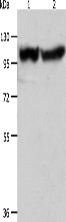 Rabbit Polyclonal Antibody to ACTN3