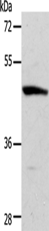 Rabbit Polyclonal Antibody to ACTR3B