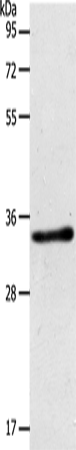 Rabbit Polyclonal Antibody to ACY3