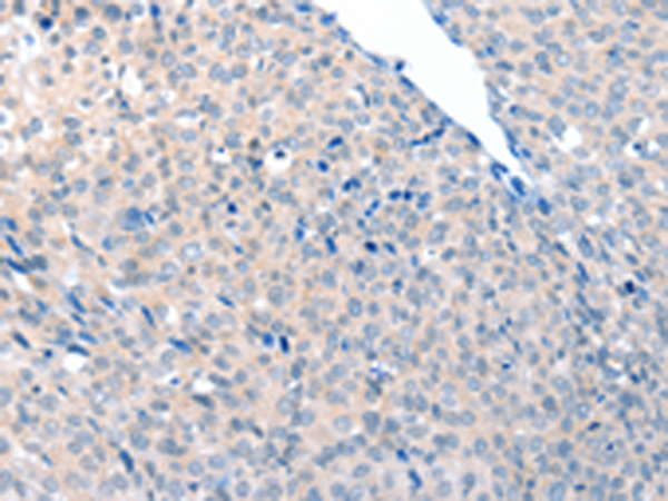Rabbit Polyclonal Antibody to ACOT8