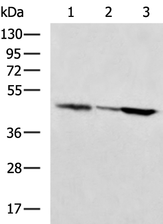 Rabbit Polyclonal Antibody to ADA