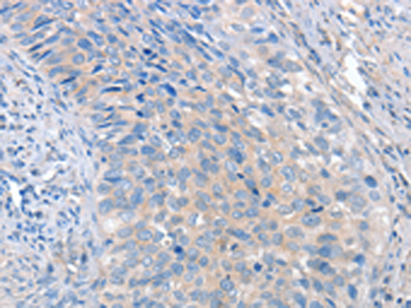 Rabbit Polyclonal Antibody to ADAM10