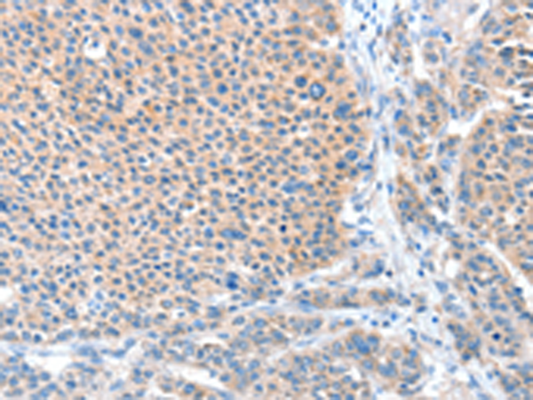 Rabbit Polyclonal Antibody to ADAM20