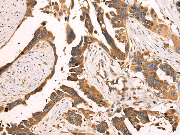 Rabbit Polyclonal Antibody to ADAM30