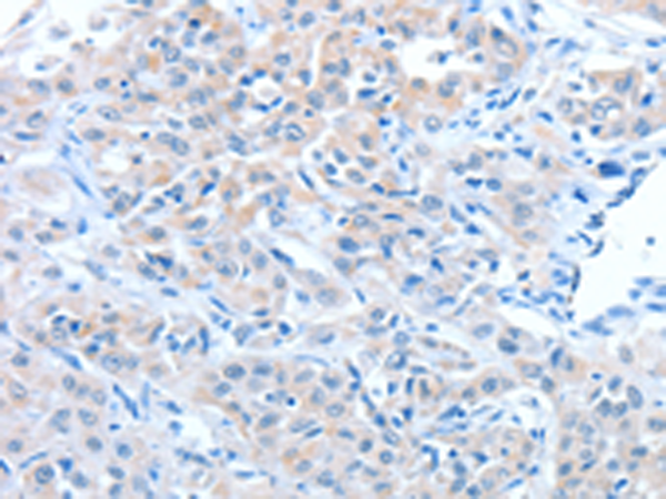 Rabbit Polyclonal Antibody to ADAM7