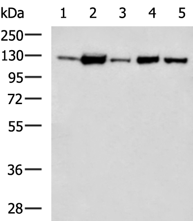 Rabbit Polyclonal Antibody to ADAM17
