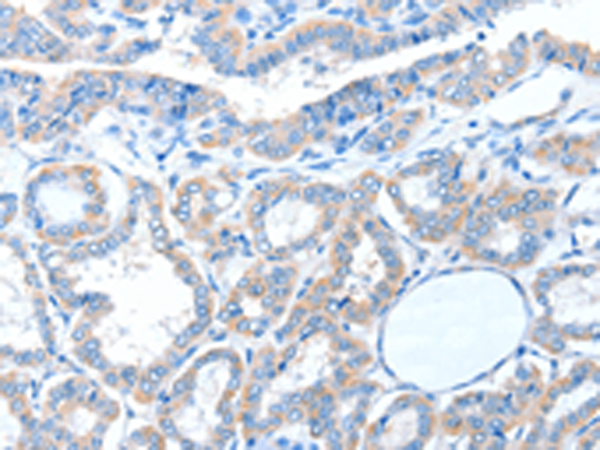 Rabbit Polyclonal Antibody to ADAM21