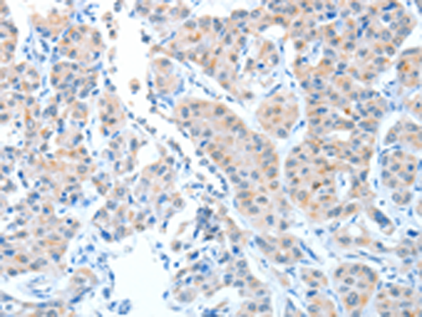 Rabbit Polyclonal Antibody to ADAMTSL1