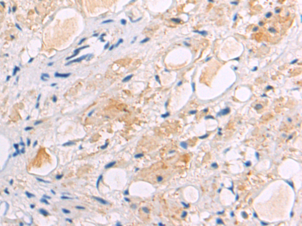 Rabbit Polyclonal Antibody to ADAMTSL2