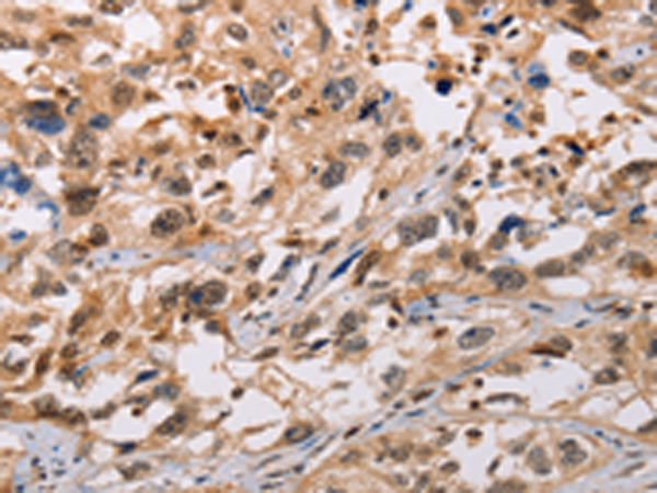 Rabbit Polyclonal Antibody to ADAMDEC1