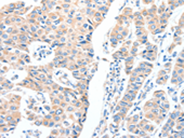Rabbit Polyclonal Antibody to ADCK1