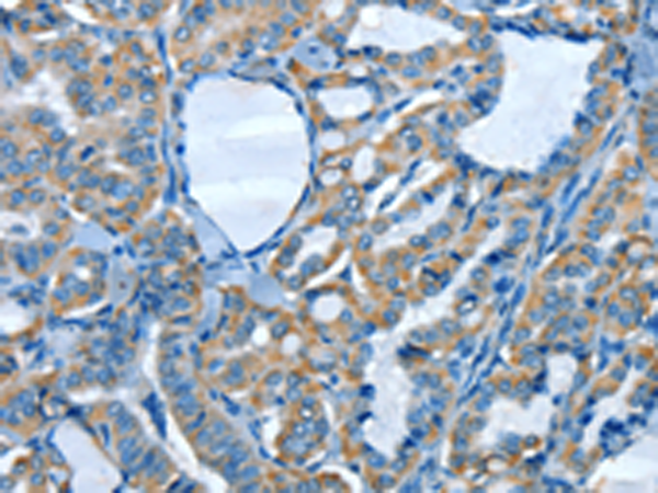 Rabbit Polyclonal Antibody to COQ8B