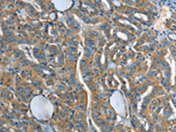 Rabbit Polyclonal Antibody to ADCY4