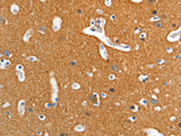 Rabbit Polyclonal Antibody to ADD2