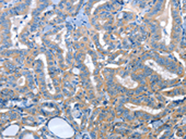 Rabbit Polyclonal Antibody to ADH4