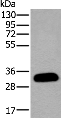 Rabbit Polyclonal Antibody to ADIPOQ