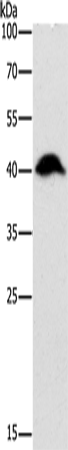 Rabbit Polyclonal Antibody to ADK