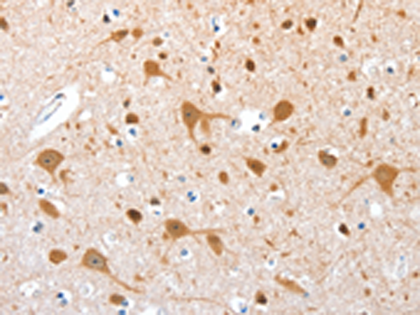 Rabbit Polyclonal Antibody to AEBP2