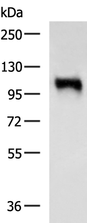 Rabbit Polyclonal Antibody to AFAP1