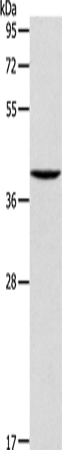 Rabbit Polyclonal Antibody to AGA